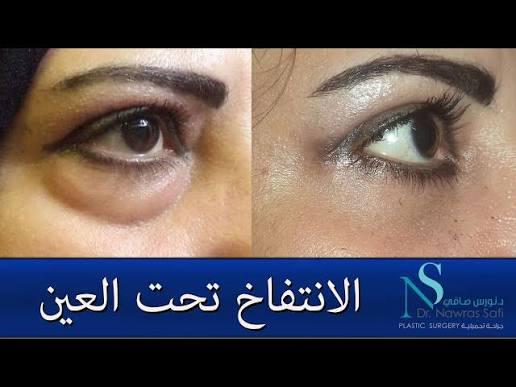پاك كريم و سيروم الحلزون ✨✨✨ - Image 4
